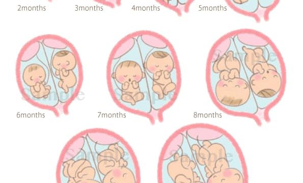 双子妊娠中 子宮 胎児